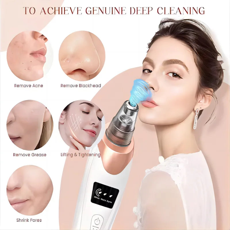 Rechargeable Blackhead Remover Vacuum – Powerful Pore Cleaner & Acne Extractor for Face & Nose