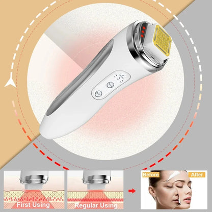 Radio Frequency Facial Lifting Massager